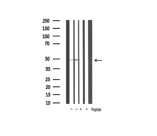 Polyclonal Rabbit anti-Human GSK3B / GSK3 Beta Antibody (IHC, IF, WB)
