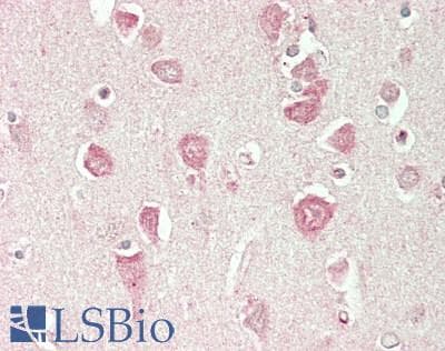 IHC-plus™ LRFN2 Antibody