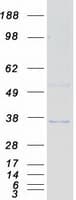 Human SEPT4 / Septin 4 Protein (Recombinant Myc-DDK (Flag))