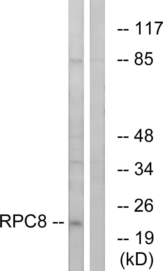 Polyclonal Rabbit anti-Human POLR3H Antibody (aa151-200, WB)