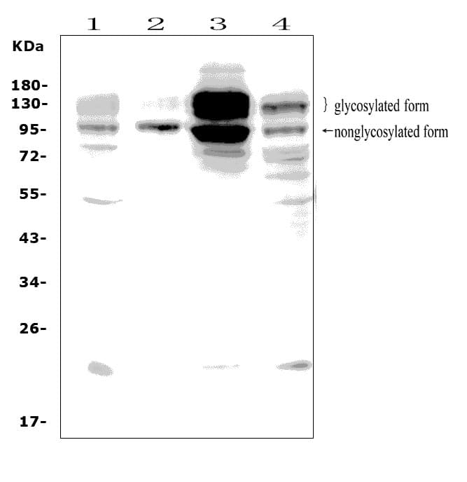 Polyclonal Rabbit anti-Human DDR2 Antibody (aa834-855, WB)