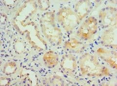 KCNN4 / KCa3.1 Antibody (aa288-427)