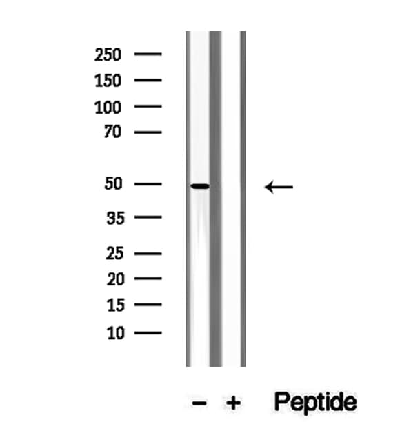 QCR2 / UQCRC2 Antibody