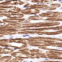TNNI3 / Cardiac Troponin I Antibody (N-Terminus)