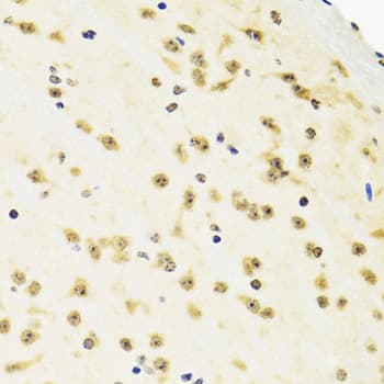 SUZ12 Antibody