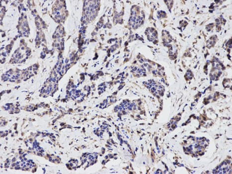 TGFBI Antibody