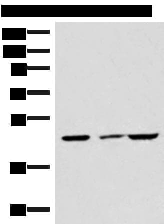 IP6K2 Antibody