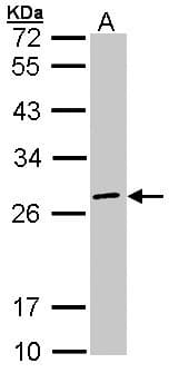 EIF3K Antibody (aa1-173)