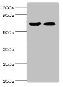 Polyclonal Rabbit anti-Human COT / CROT Antibody (aa1-87, IHC, WB)