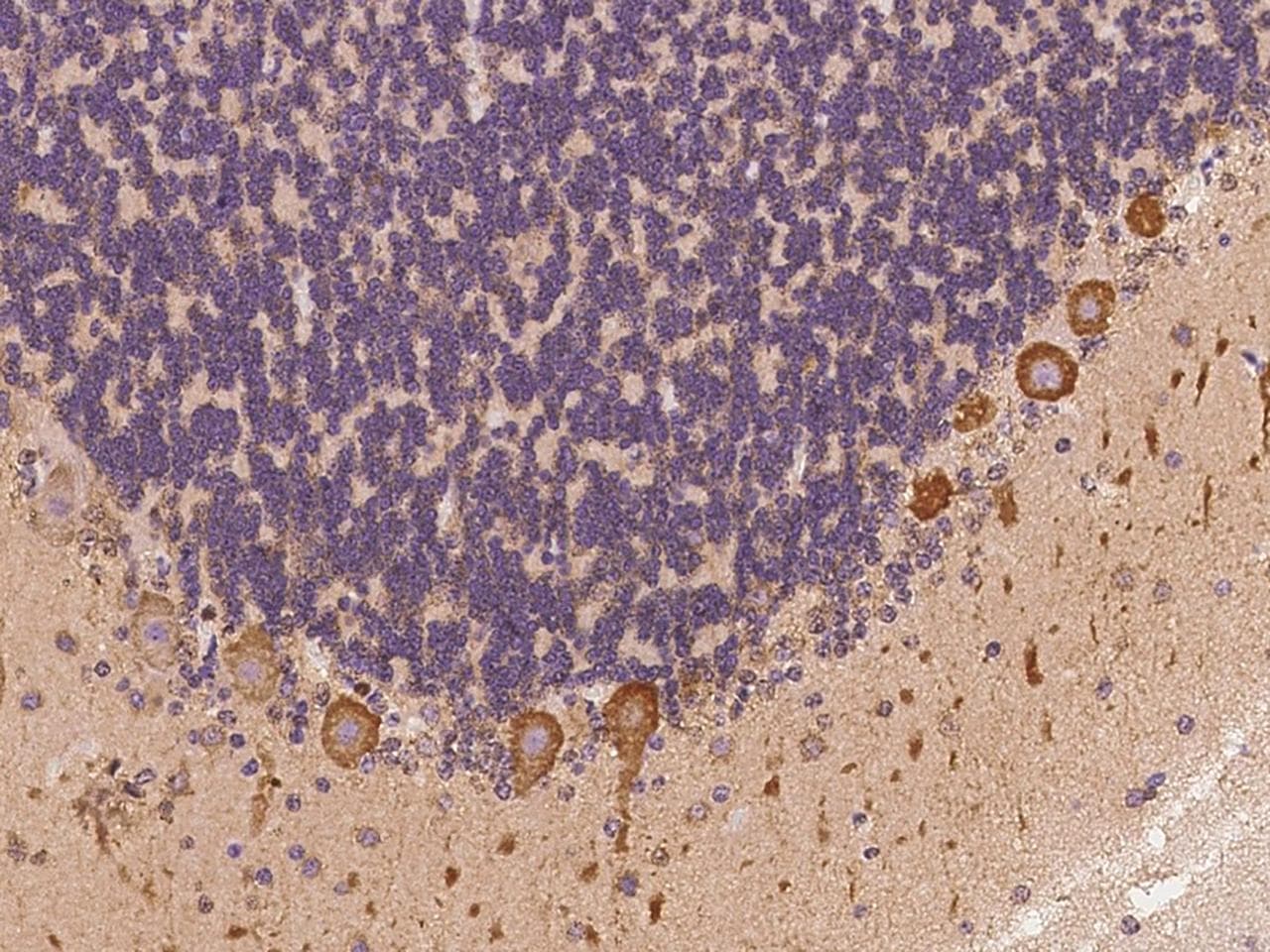 Polyclonal Rabbit anti-Human MAP7D2 Antibody (IHC)