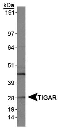 TIGAR Antibody