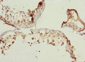 WNT5B Antibody
