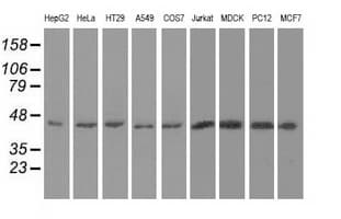 UHMK1 / KIS Antibody (clone OTI5E10)