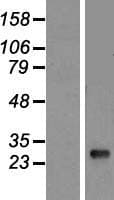 HLA-DQB1 Protein (Over-Expression Lysate Myc-DDK (Flag))