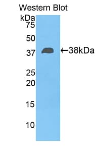 FBLN4 / EFEMP2 Antibody (aa136-225, PE)