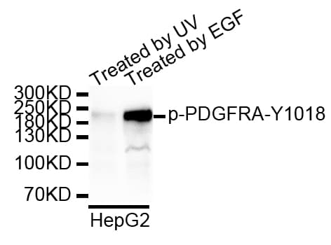 PDGFRA / PDGFR Alpha Antibody (phospho-Tyr1018)