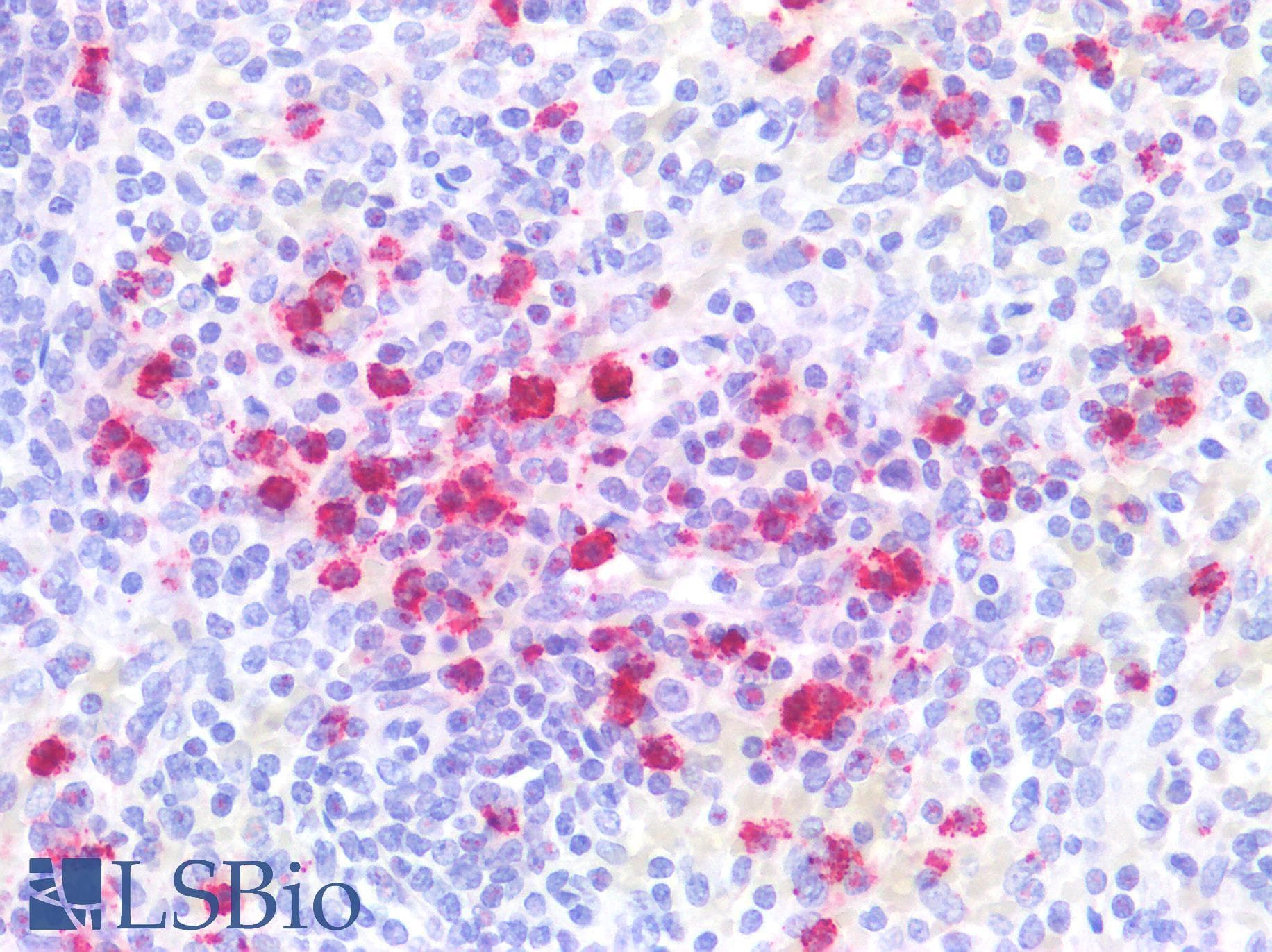 PathPlus™ CTSG / Cathepsin G Antibody (Internal)