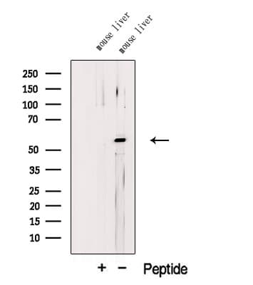 Polyclonal Rabbit anti-Human LPL / Lipoprotein Lipase Antibody (WB)