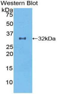 GDF11 / GDF-11 Antibody (aa138-386)