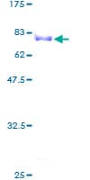 Human ZNF193 Protein (Recombinant GST)