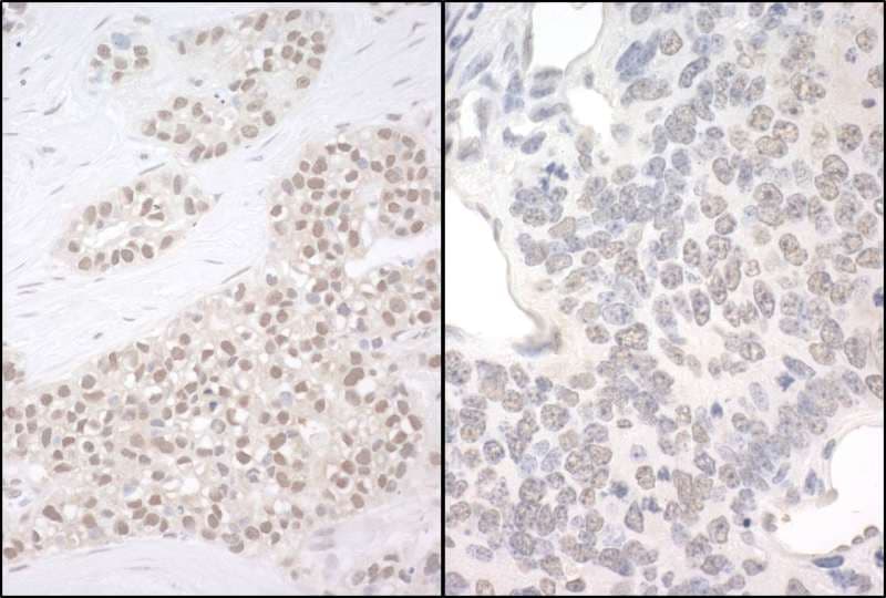 Polyclonal Rabbit anti-Human PQBP1 Antibody (aa215-265, IHC, WB)
