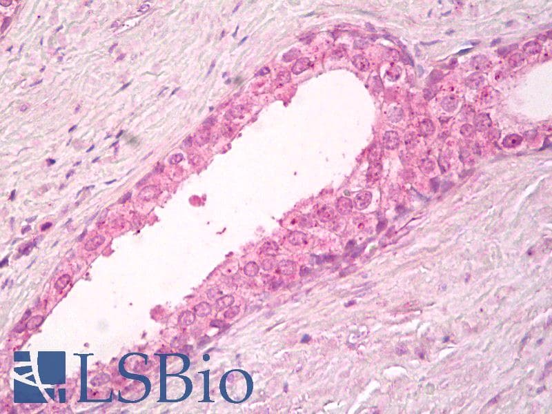 IHC-plus™ CYTIP Antibody (aa2-14)