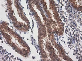 DSTN / Destrin Antibody (clone OTI2F7)