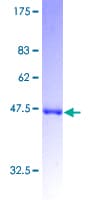 Human GCAP / GUCA1A Protein (Recombinant GST)
