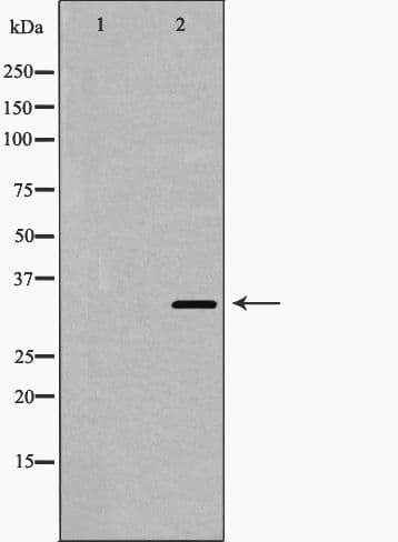 Polyclonal Rabbit anti-Human HMOX1 / HO-1 Antibody (IHC, WB)