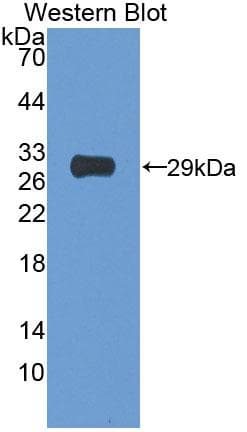 BIRC1 / NAIP Antibody (aa923-1148, Cy3)