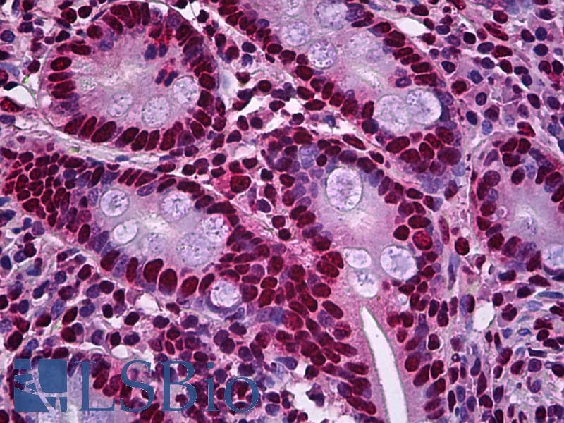 IHC-plus™ OTUD7B / Cezanne Antibody (clone 2B4)