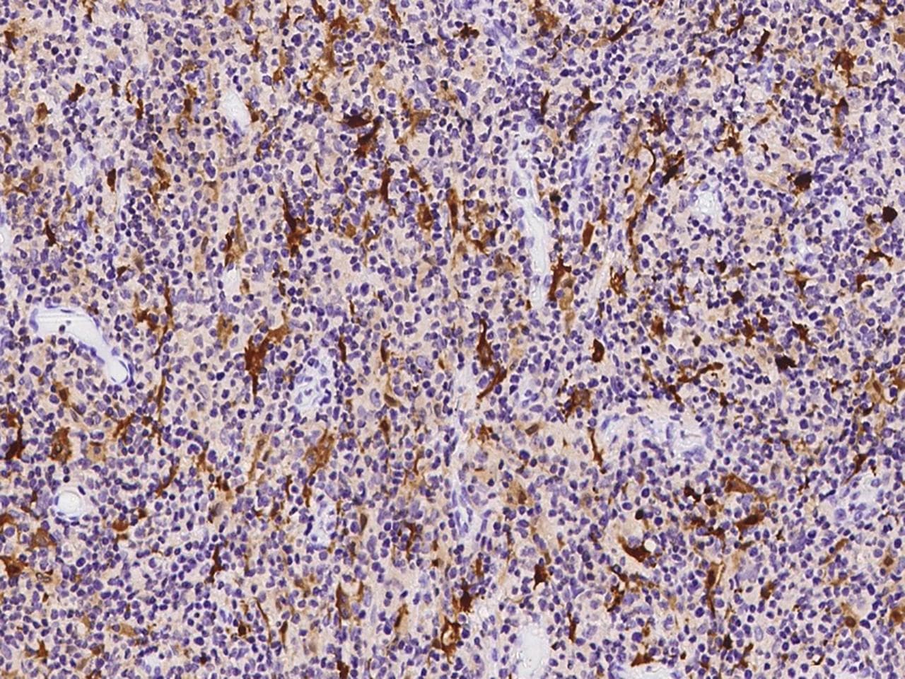 S100B / S100 Beta Antibody