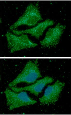ACAA1 Antibody (clone AT9E5)