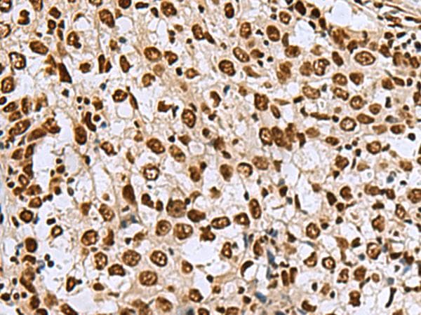 MYEF2 Antibody