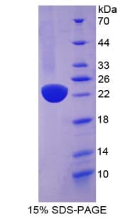 Human REG1B Protein (Recombinant His-T7)