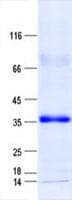 Human ZNF625 Protein (Recombinant His, N-Terminal)
