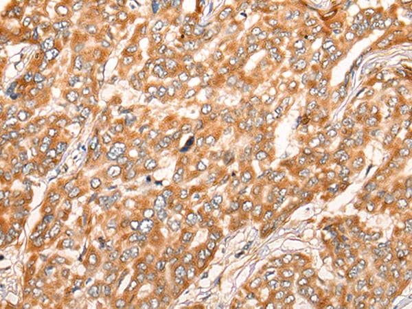 Polyclonal Rabbit anti-Human ZMYND10 Antibody (IHC)
