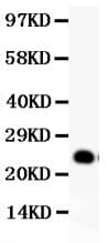 GDNF Antibody (aa78-211)