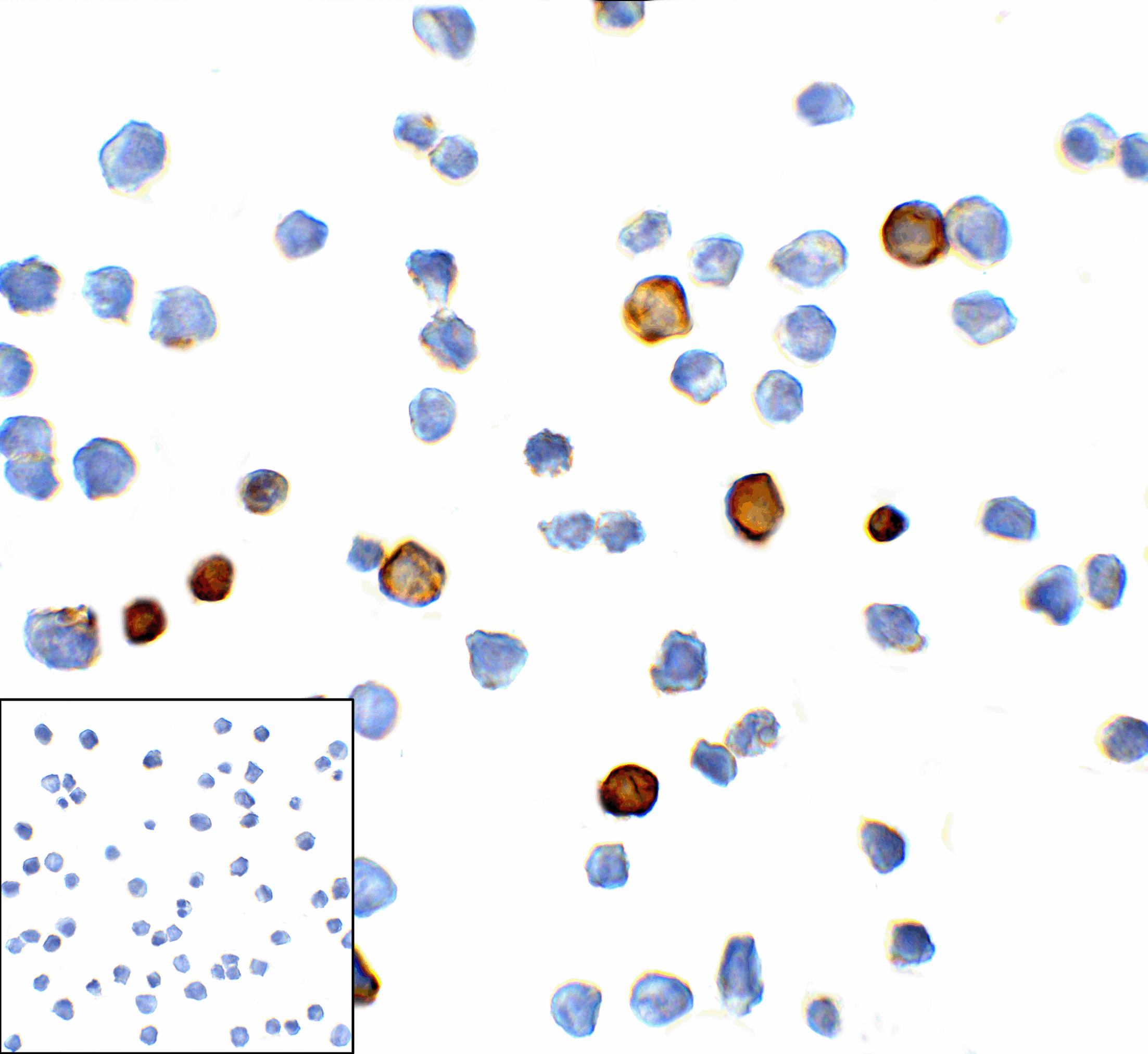 Monoclonal Mouse anti-Human HAVCR2 / TIM-3 Antibody (clone 1C6, IHC, IF)