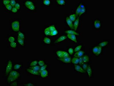 MAP2K7 / MEK7 Antibody