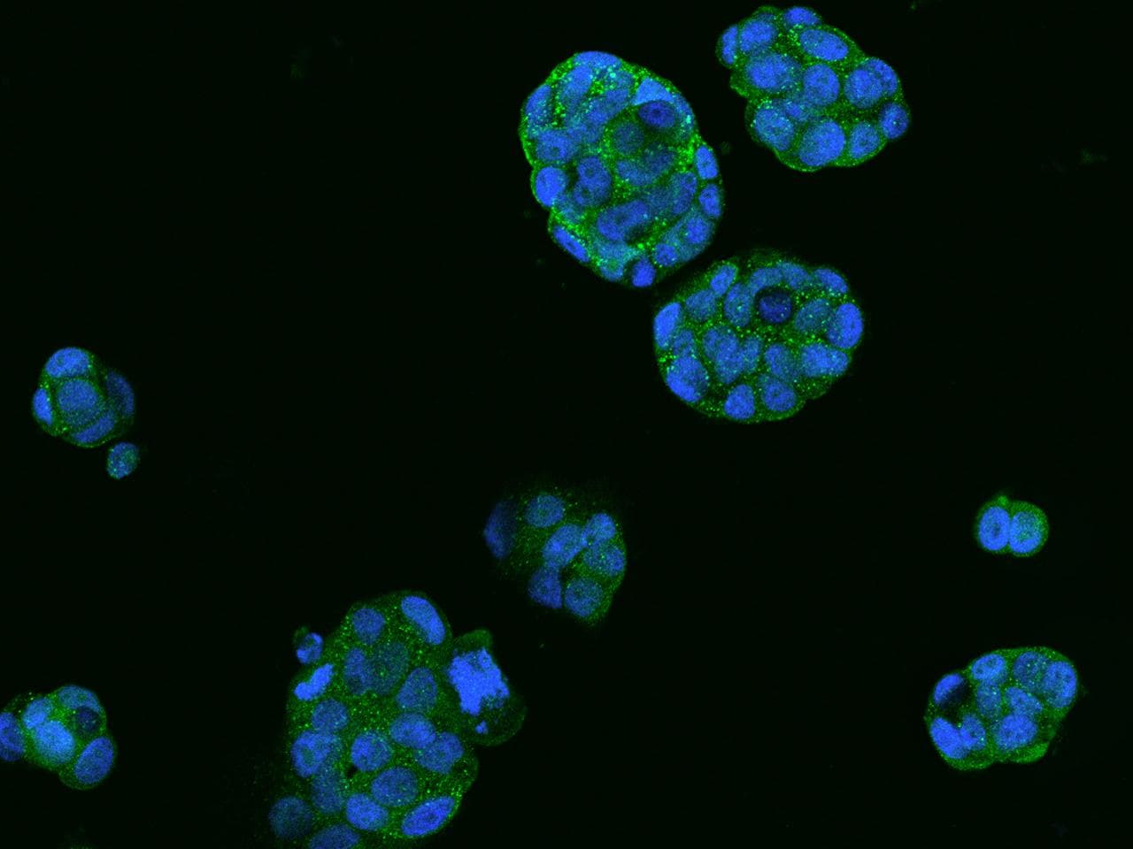 Polyclonal Rabbit anti-Human SRCIN1 / SNIP Antibody (IHC, IF)