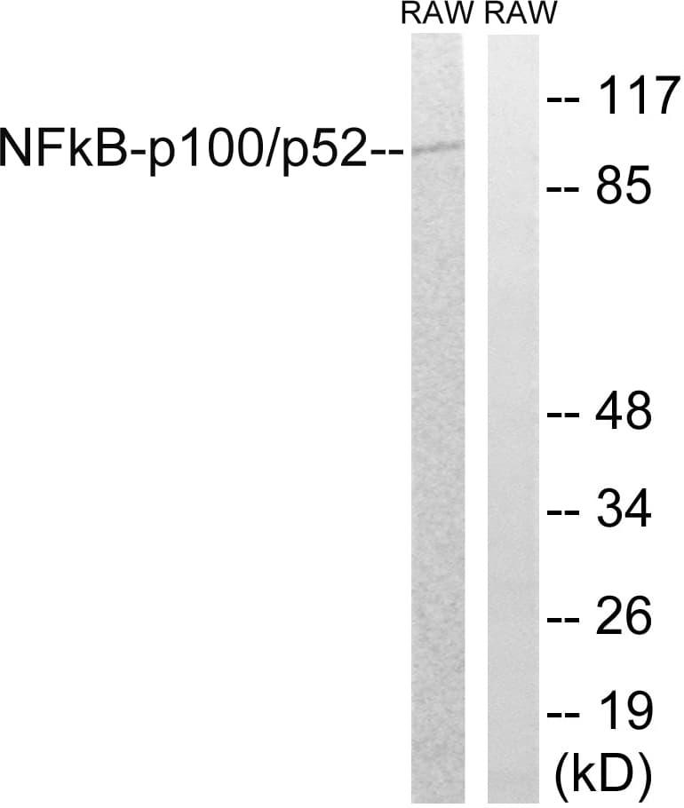 IHC-plus™ Polyclonal Rabbit anti-Human NFKB2 Antibody (aa836-885, IHC, WB)