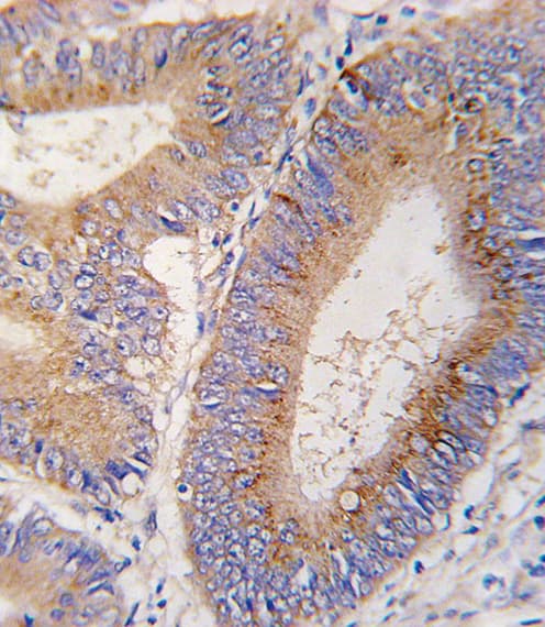 Polyclonal Rabbit anti-Human GDF11 / GDF-11 Antibody (aa32-61, IHC, WB)