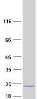 Human MARCH2 Protein (Recombinant Myc-DDK (Flag))