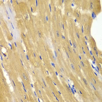 Polyclonal Rabbit anti-Human AK1 / Adenylate Kinase 1 Antibody (IHC, IF, WB)