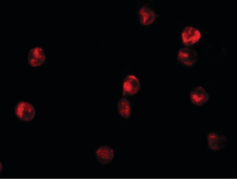 Polyclonal Rabbit anti-Human KDM6B / JMJD3 Antibody (IF, WB)