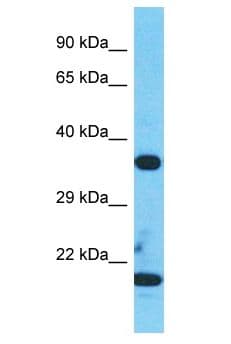 TESPA1 / KIAA0748 Antibody (aa256-305)