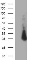 CHAC1 / MGC4504 Antibody (clone OTI1G7, Carrier-free)