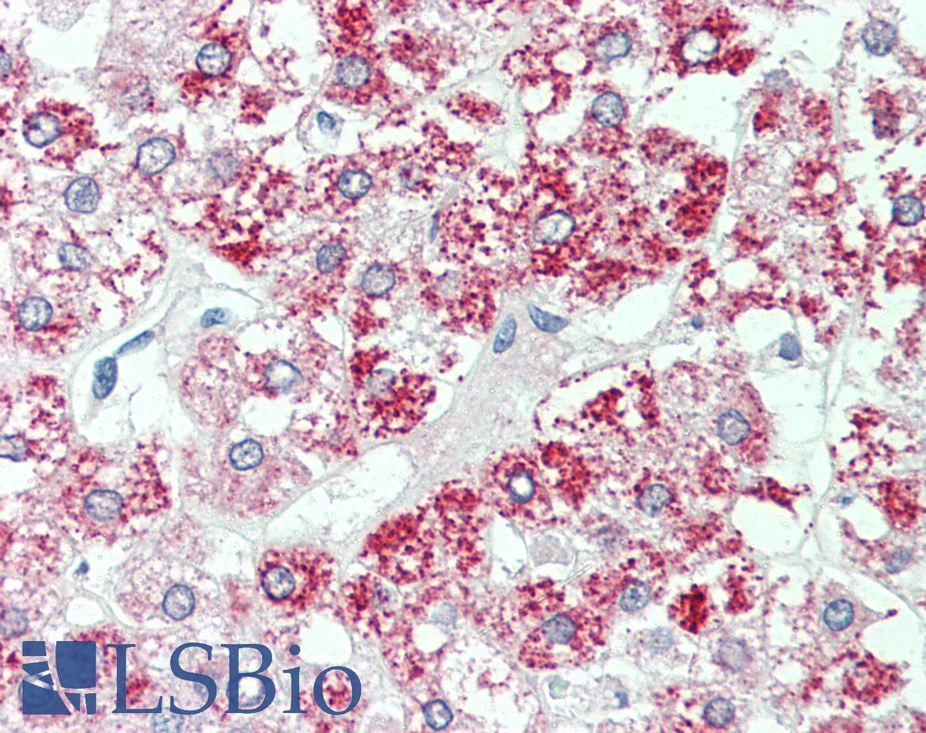 IHC-plus™ SLC7A2 Antibody (Internal)