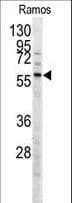 MEN1 / Menin Antibody (Thr594)